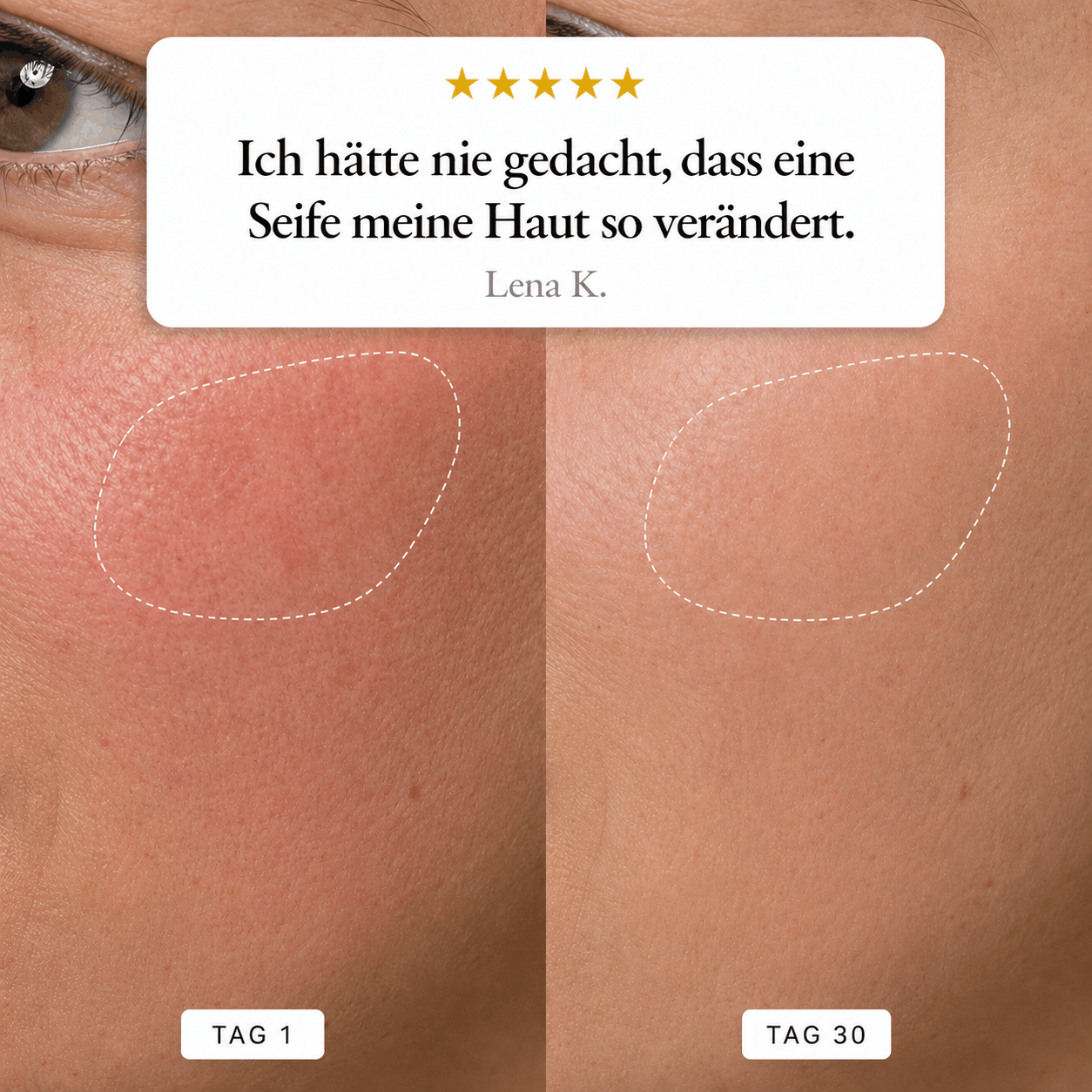 Teint Précieux — Die minimalistische Seife, die fünf Skincare-Produkte ersetzt. Skinimalistisch.